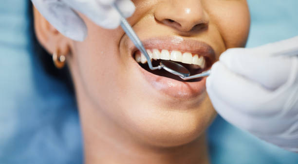 Best Emergency Dentist for Knocked-Out Tooth in Henry, IL